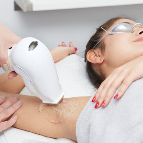 laser_hair_removal laser_hair_removal