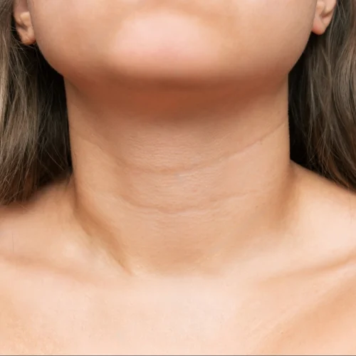 neck_lines-transformed neck_lines-transformed