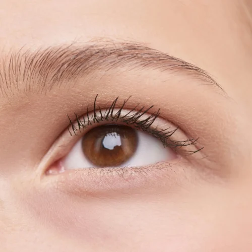 under-eye-darkening under-eye-darkening