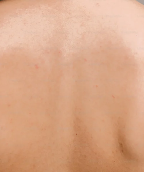 uneven-skin-tone uneven-skin-tone